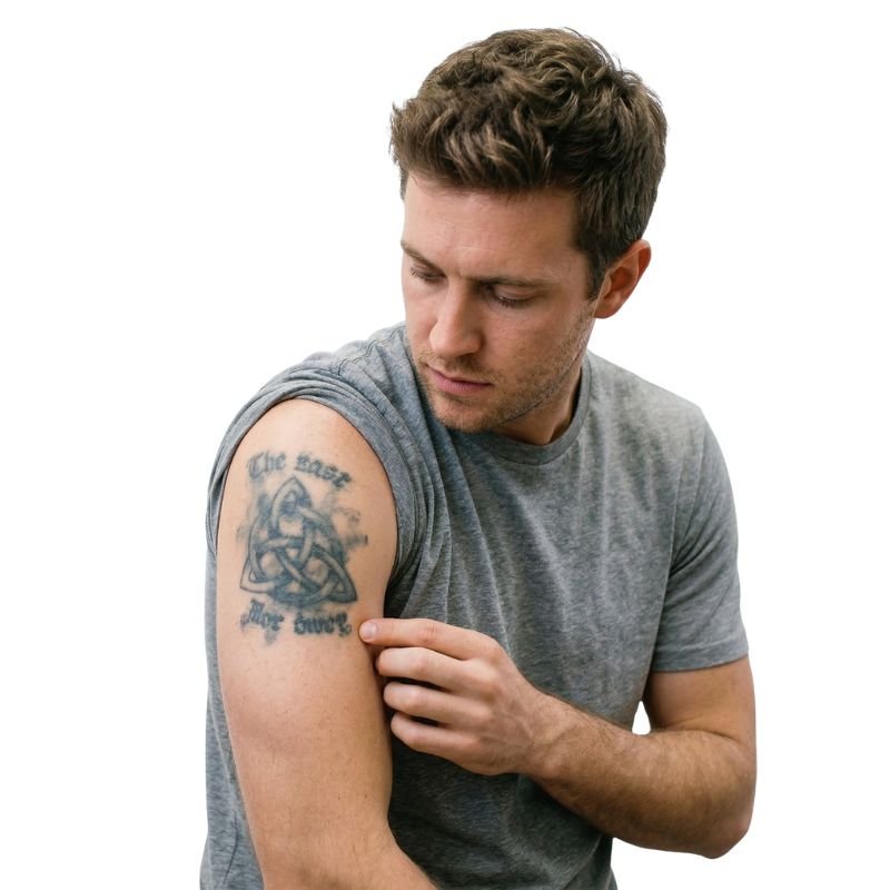 Laser tattoo removal at Bella Luce Med Spa